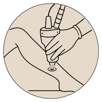 LASER ONTHARING